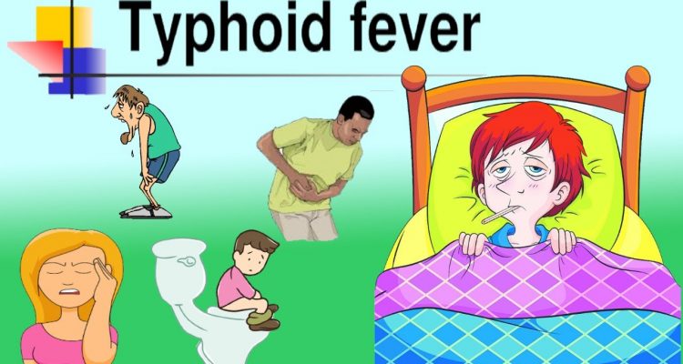 Typhoid symptoms