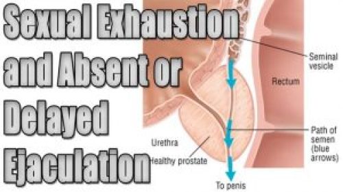 sexual exhaustion and erectile dysfunction