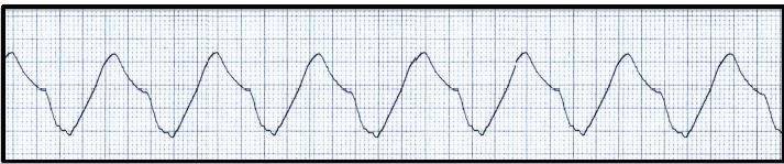 sine waves 